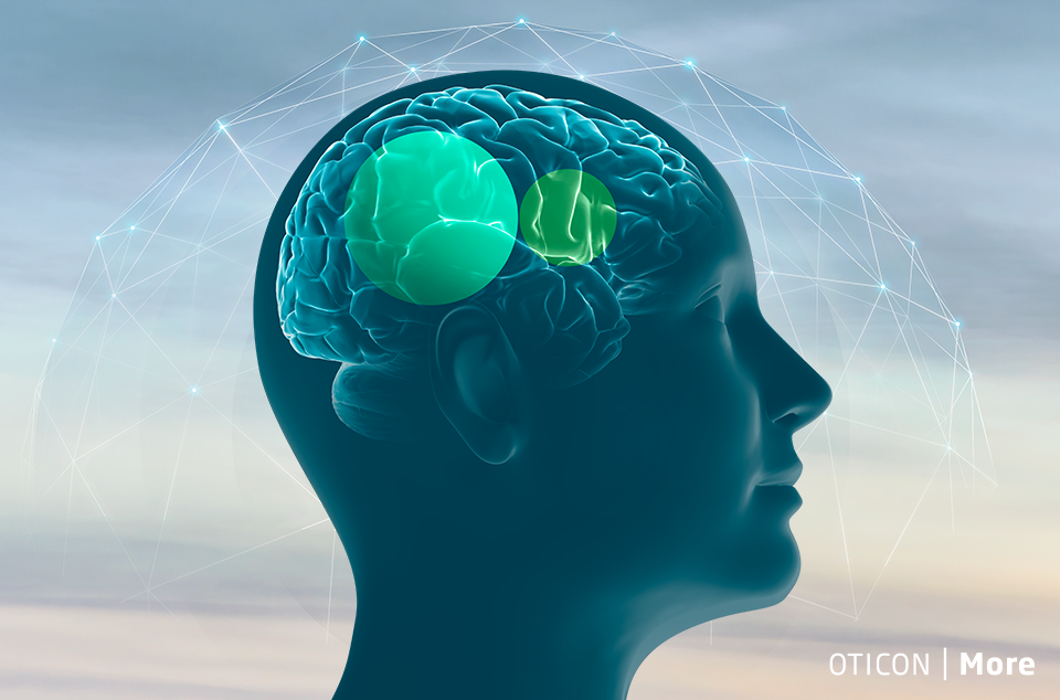 oticon-more_brainhearing