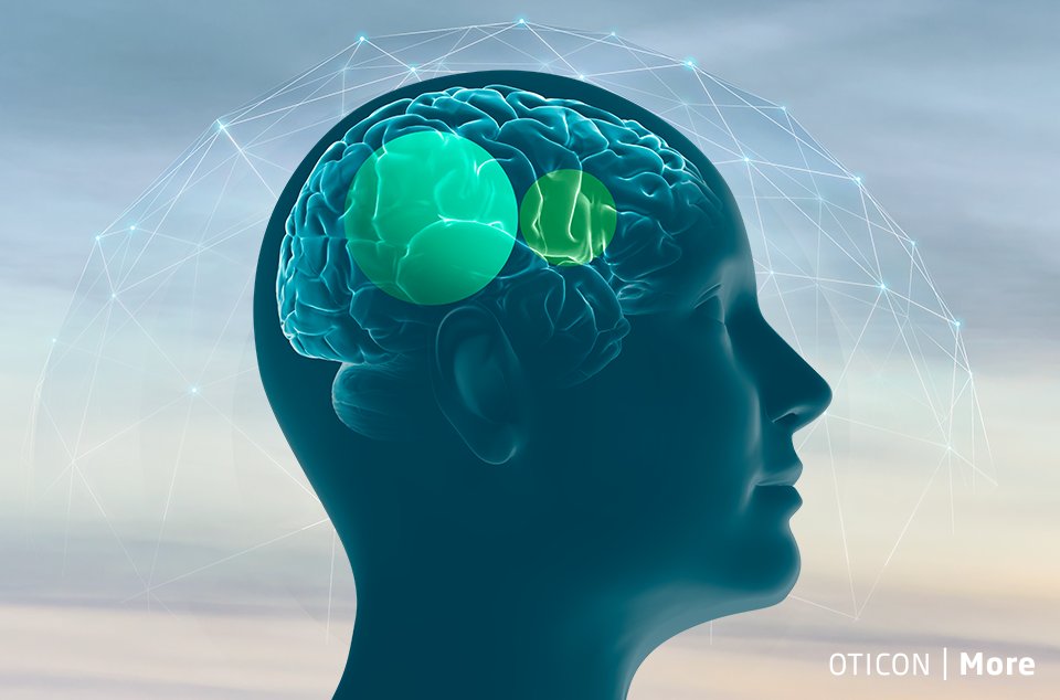 oticon-more_brainhearing