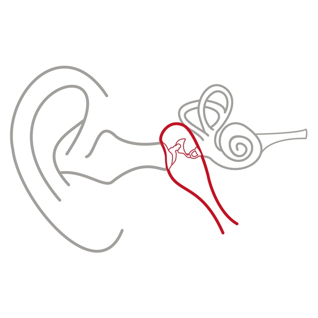 Illustration af det ydre øre, mellemøret og det indre øre, hvor mellemøret er fremhævet med rød