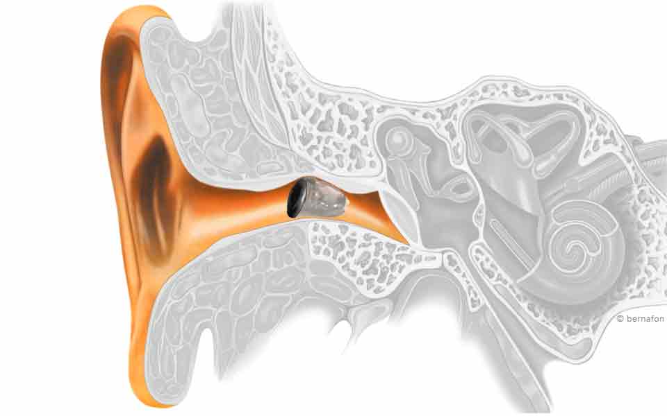 All_CloseUp_0011_IIC