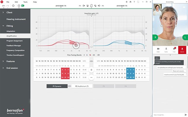 Billede af Bernafon Remote Fitting i tilpasningssoftwaren Oasisnxt med hørespecialist og brugers video i øverste højre hjørne