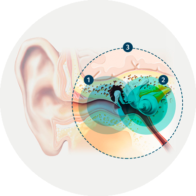 three-types-hearing-loss