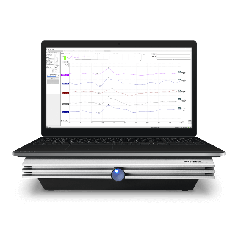 Programvaren Interacoustics Eclipse Aided Corticall-test vises på skjermen til en bærbar datamaskin.