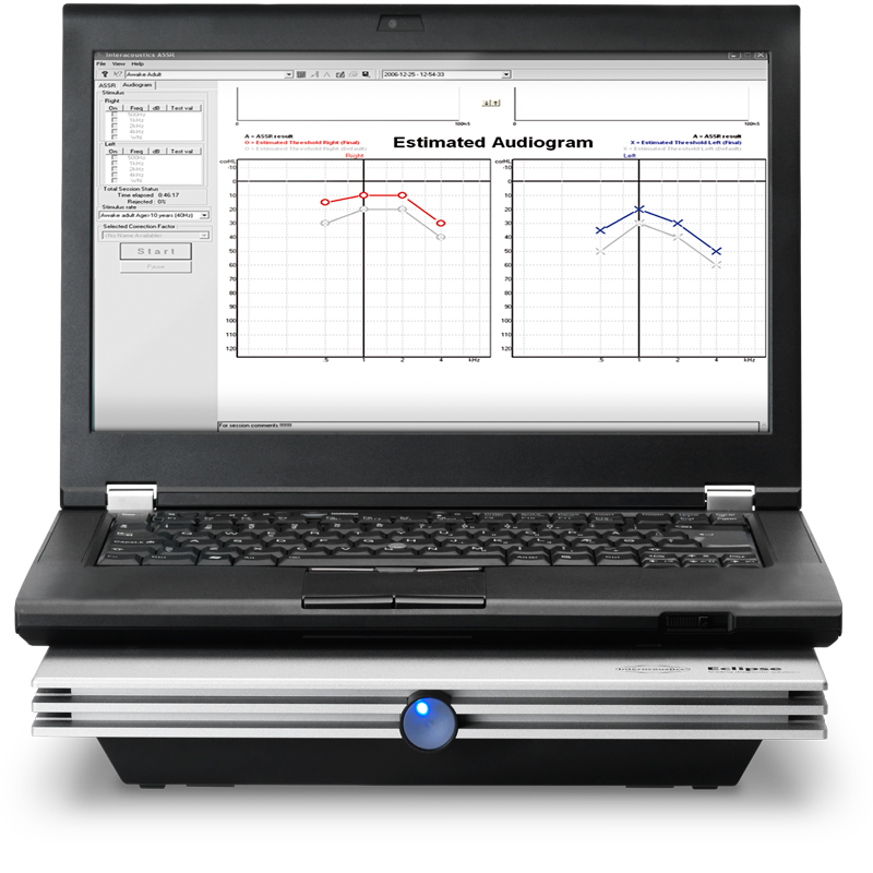 Interacoustics Eclipse ASSR, et auditive steady state response system med en stor skærm, der viser auditive data, og et tastatur til indtastning af data