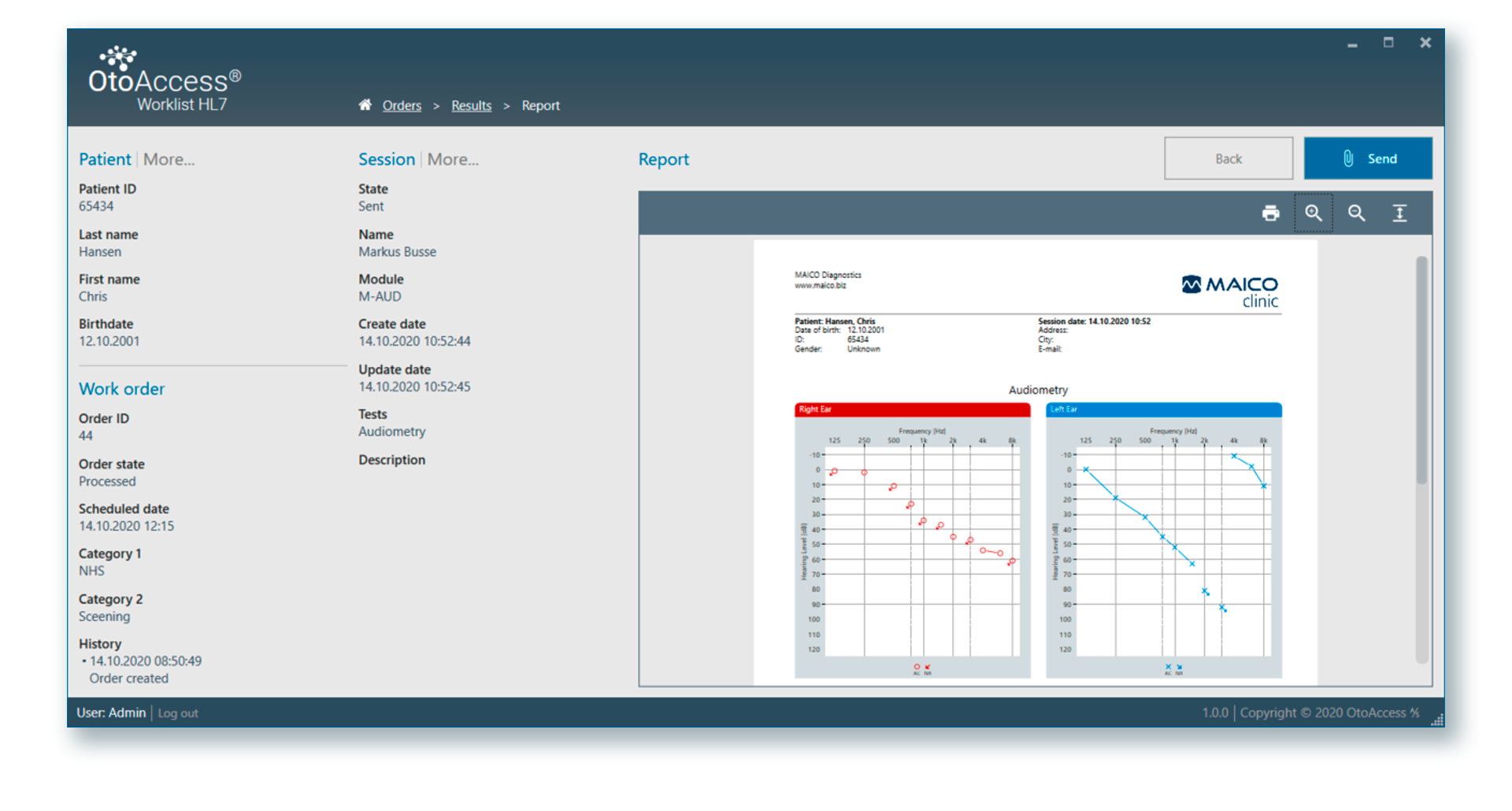 MAICO Worklist HL7 Audiology Software MAICO Diagnostics
