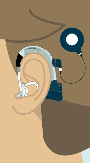 300x540-retention-ear-plug
