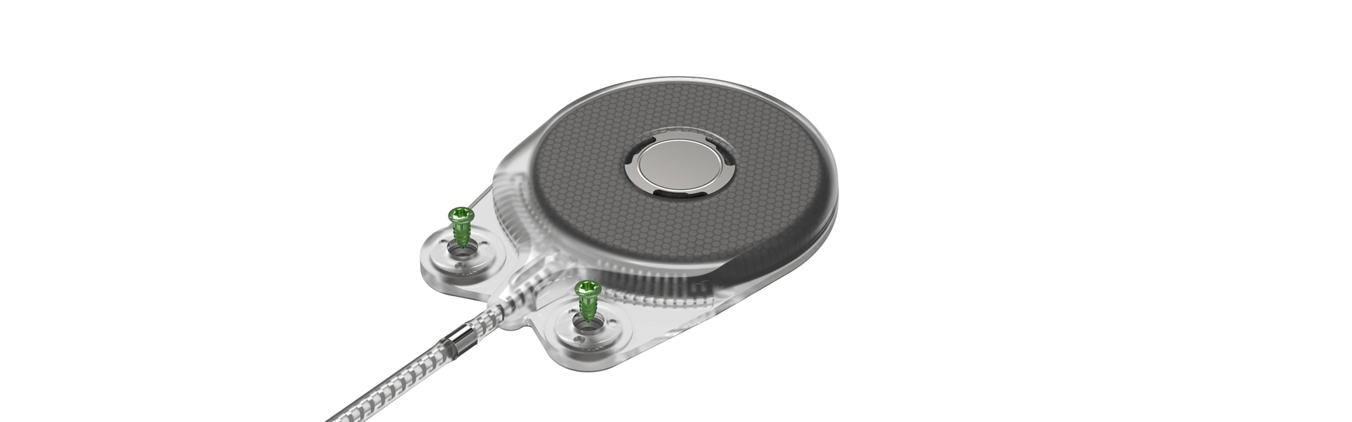 Proven and safe screw fixation Neuro System Oticon Medical