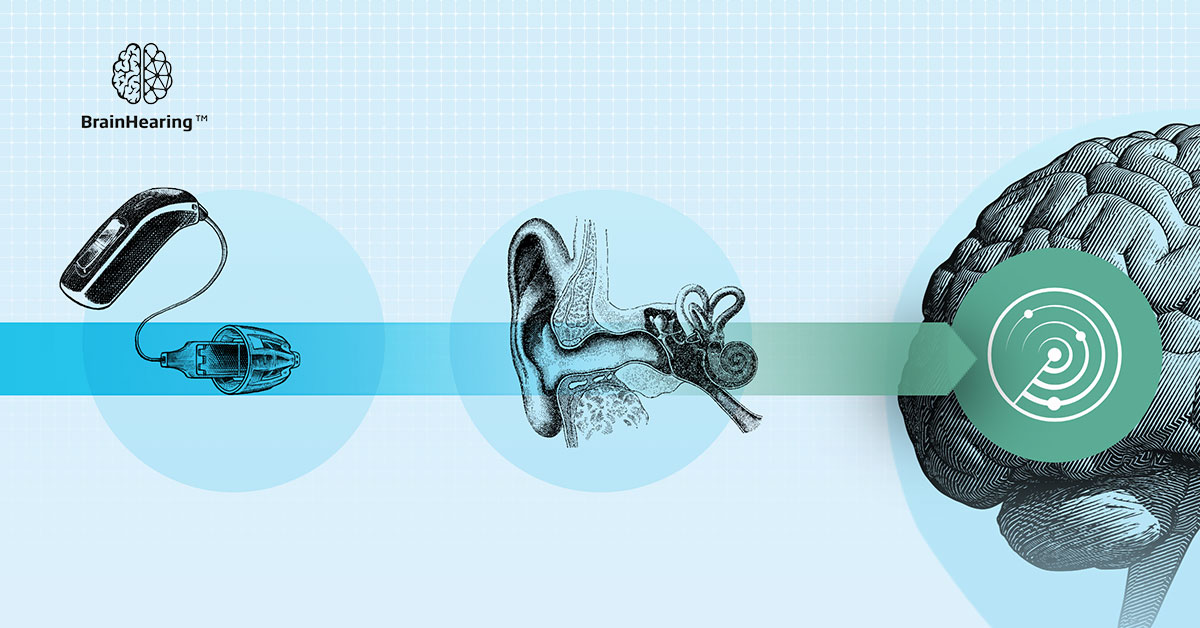 How can hearing loss affect your brain? Oticon blog