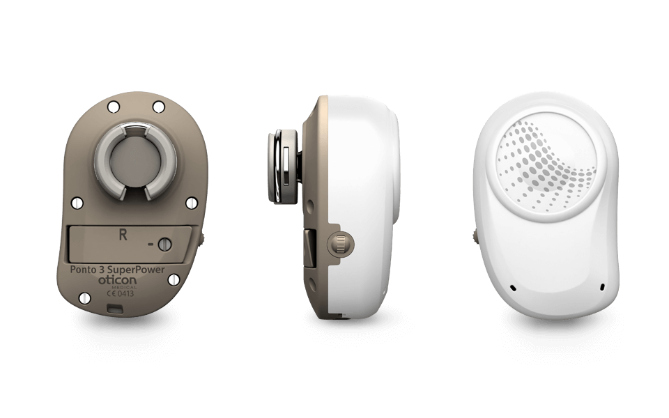 Ponto 3 SuperPower - 360