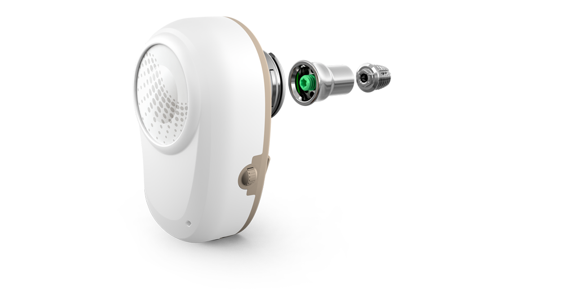 The Ponto implant system has a pure medical-grade titanium surface, which has been proven for bone anchored hearing surgery.