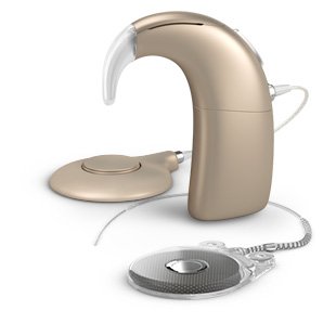 Neuro 2 - cochlear implant