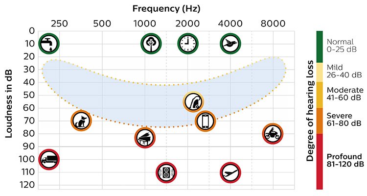 Understand hearing loss and how to prevent it | Philips