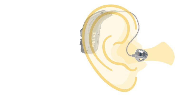 Dibujo de un oído con un audífono retroauricular Philips HearLink mostrando su posicionamiento exacto.