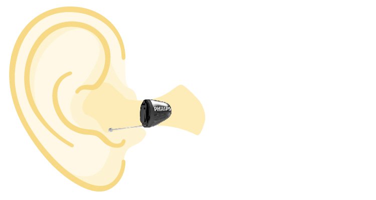 Dibujo de un oído con un audífono intrauricular Philips HearLink mostrando su posicionamiento exacto.