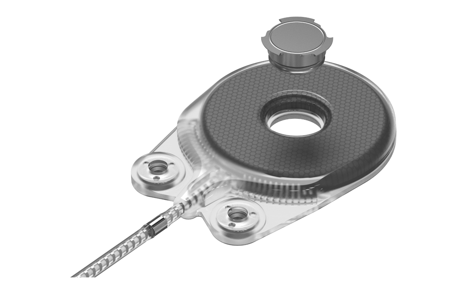 Safe for MRI scanning