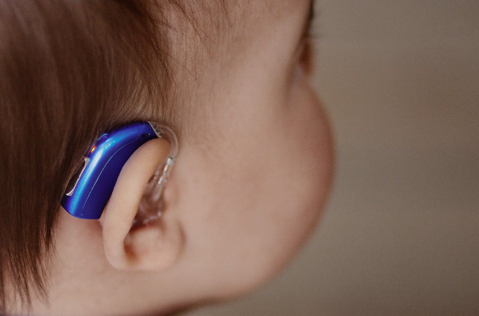 gros plan oreille de bébé avec appareil auditif bleu