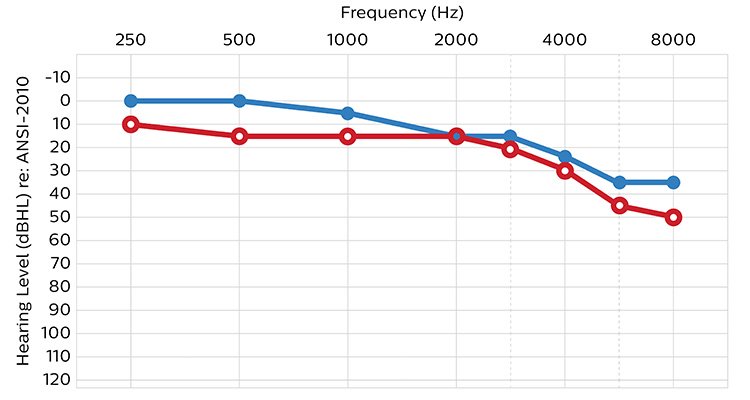An audiogram showing hearing ability in terms of sound volume (or intensity) measured in decibels and frequency in Hertz