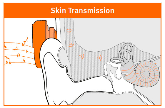 skintransmission