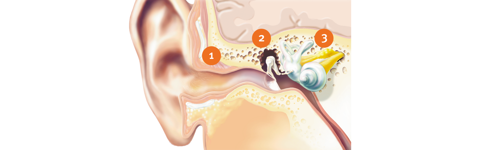 How does hearing work